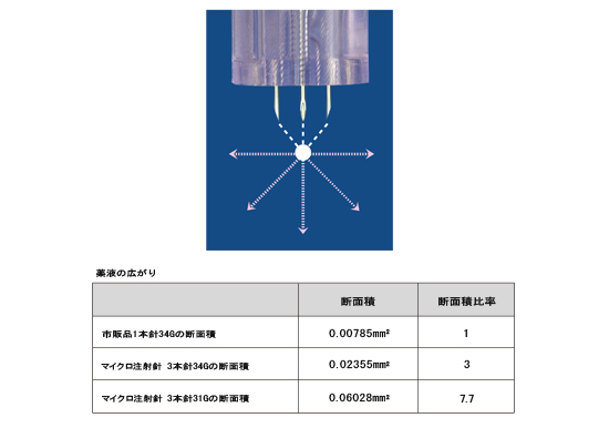 ３本針のメリット