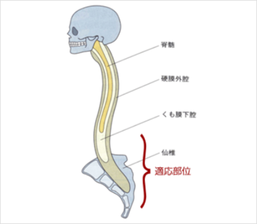 用法