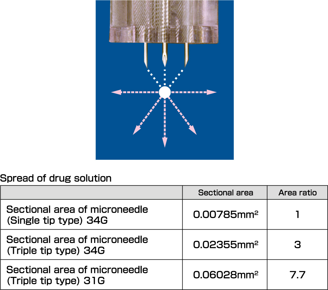 Spread of drug solution