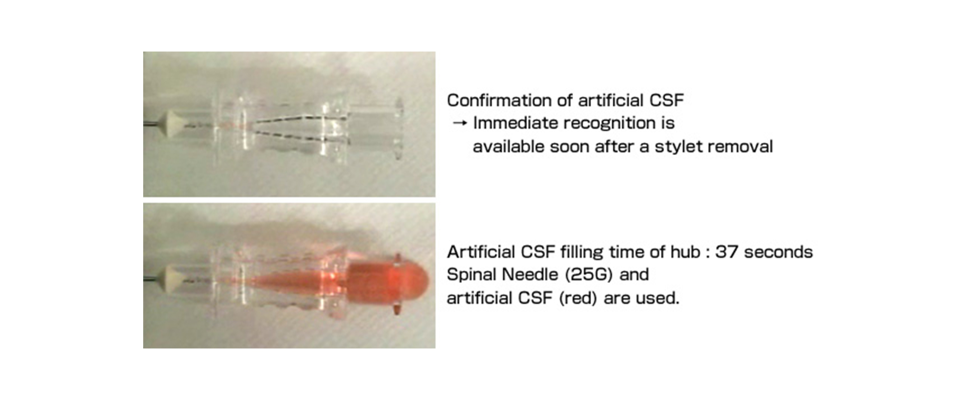 Fast CSF backflow